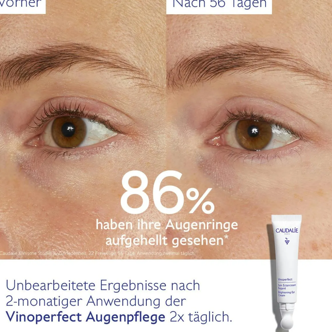 Aufhellende Augenpflege mit Koffein & Niacinamid