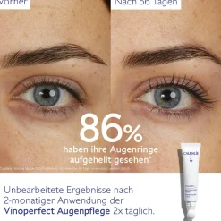Aufhellende Augenpflege mit Koffein & Niacinamid