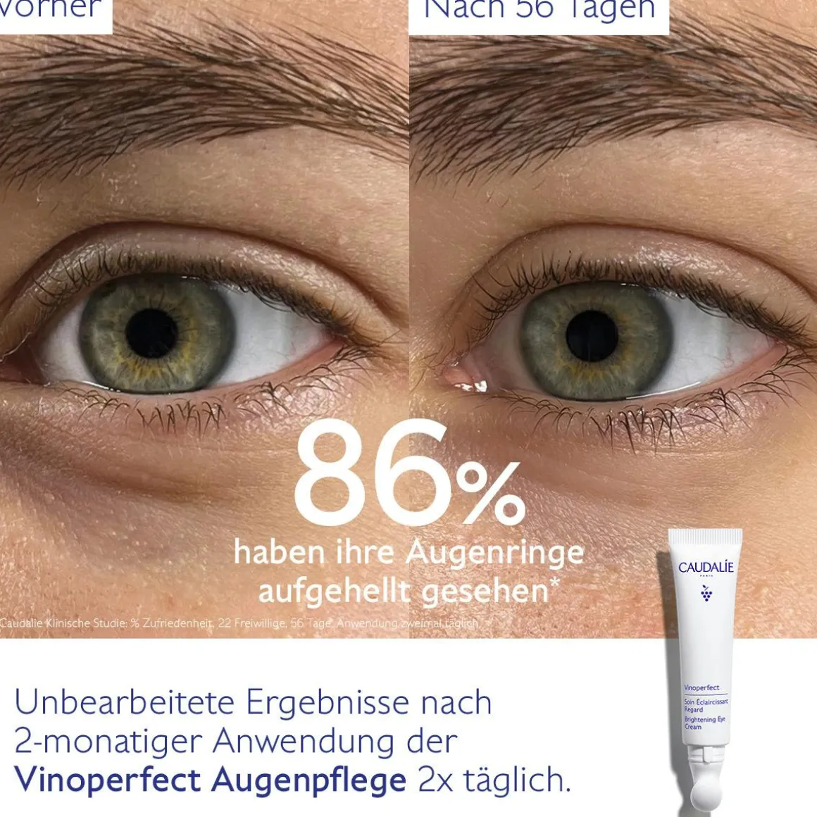Aufhellende Augenpflege mit Koffein & Niacinamid