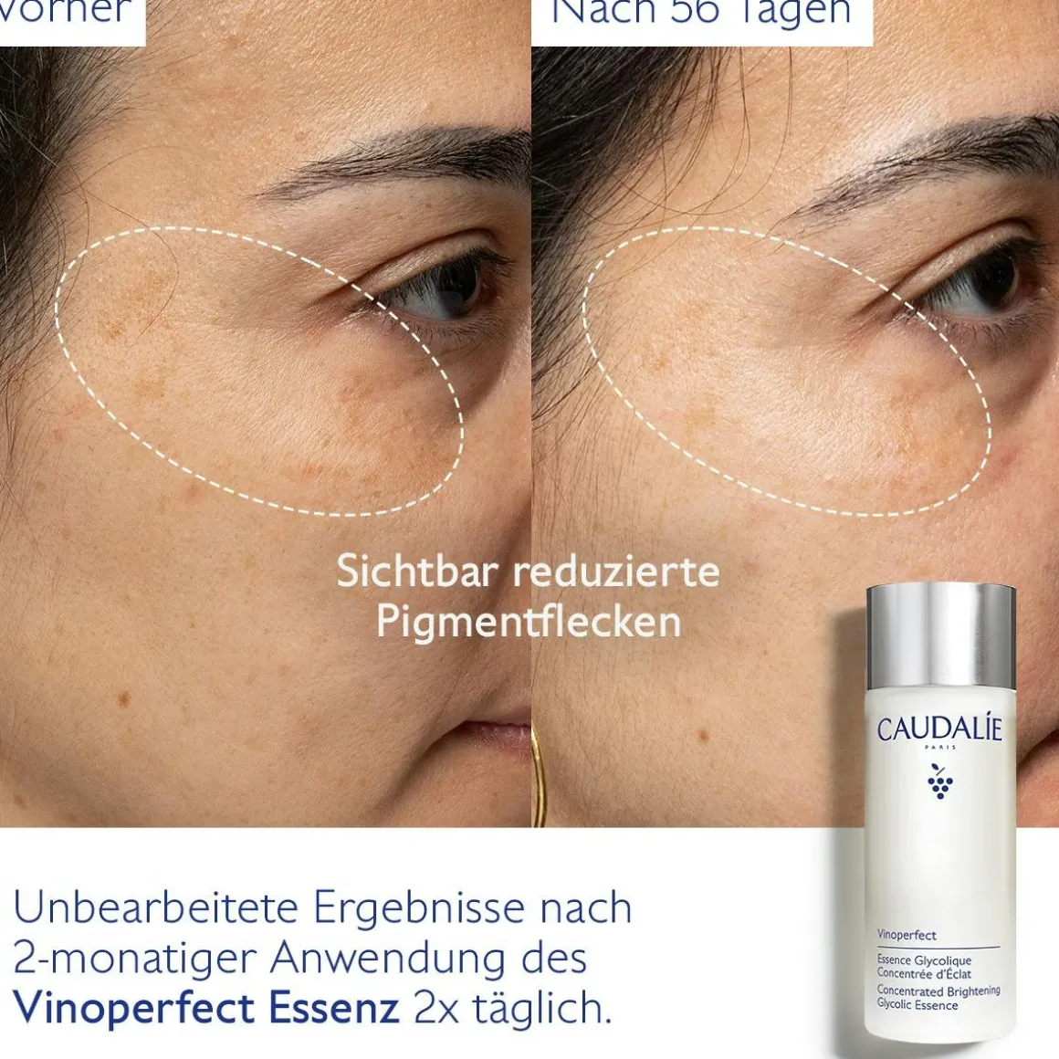 Essenz mit Glykolsäure für mehr Ausstrahlung