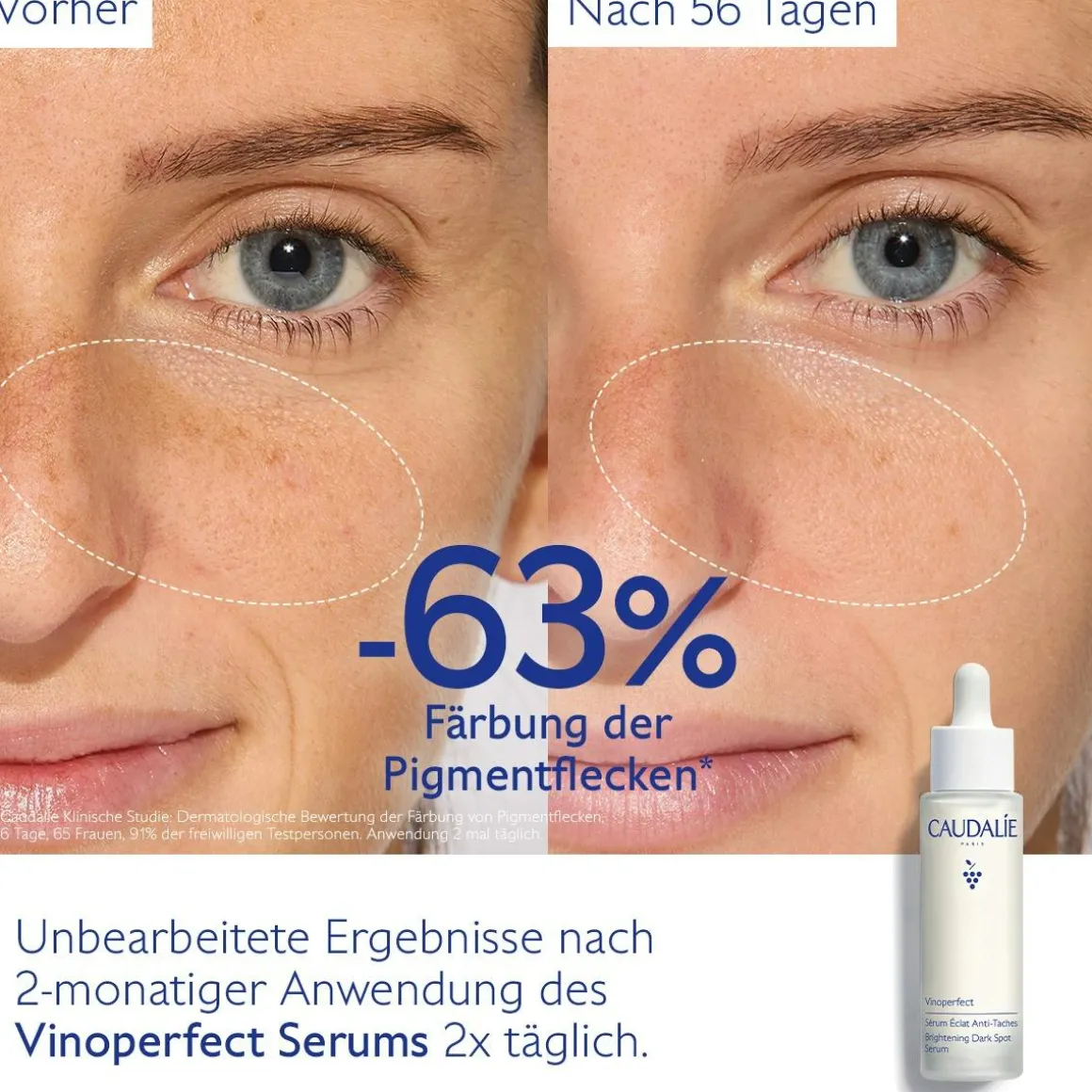 Serum für mehr Ausstrahlung und gegen Pigmentflecken mit Viniferine, Alternative zu Vitamin C - 50ml