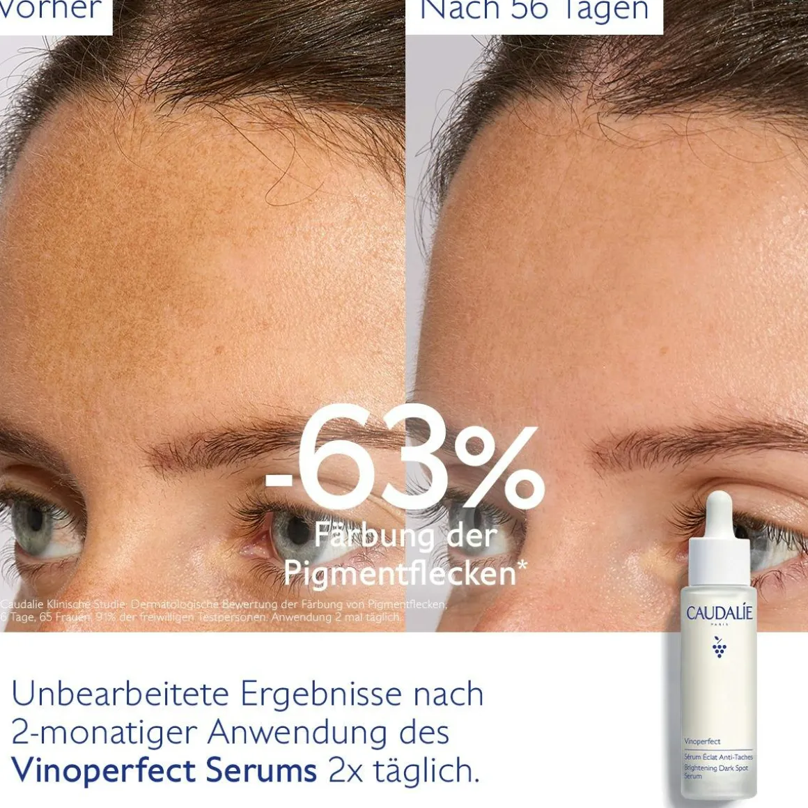 Serum für mehr Ausstrahlung und gegen Pigmentflecken mit Viniferine, Alternative zu Vitamin C - 50ml