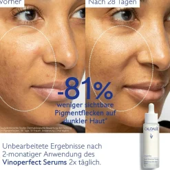 Serum für mehr Ausstrahlung und gegen Pigmentflecken mit Viniferine, Alternative zu Vitamin C - 50ml