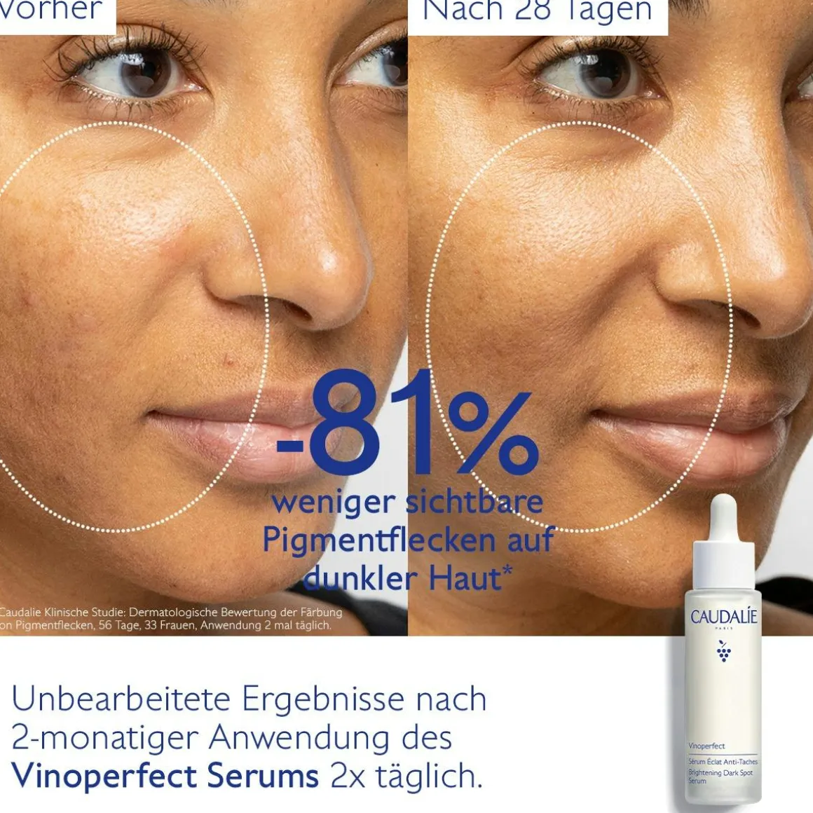 Serum für mehr Ausstrahlung und gegen Pigmentflecken mit Viniferine, Alternative zu Vitamin C - 50ml